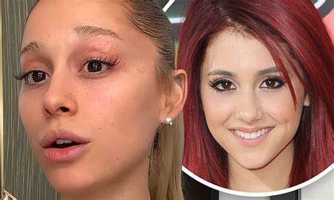 Ariana Grande Admits She Had A Ton Of Lip Filler And Botox For Years