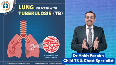 Pulmonary Or Chest Tuberculosis Symptoms Diagnosis Treatment Dr