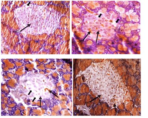 Acinar Cells And Islets Of Langerhans