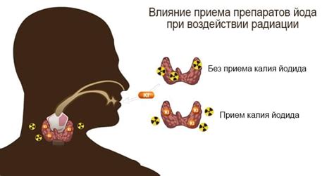 Йод в таблетках от радиации: когда и как принимать?