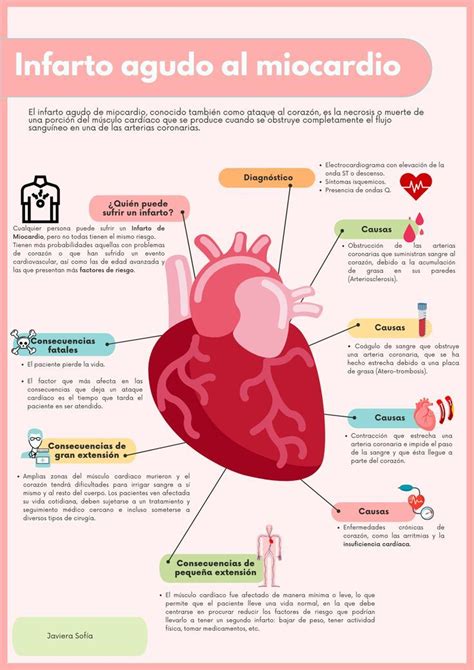 Infarto Agudo Al Miocardio Causas Y Consecuencias Cosas De