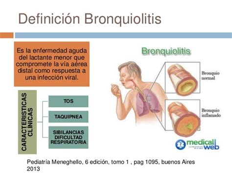 Bronquiolitis