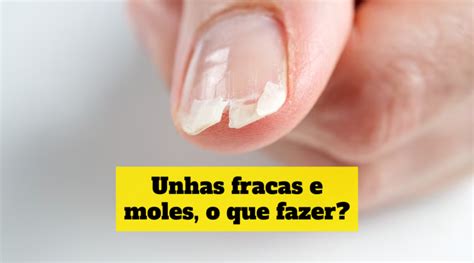 Unhas Fracas E Moles O Que Fazer Beleza Lucrativa