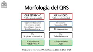 Paro cardiorespiratorio o Shock profundo Actividad eléctrica sin