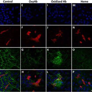 Oxidized Hb Induces NFKB Signaling Pathway Mixed Glial Cells Were