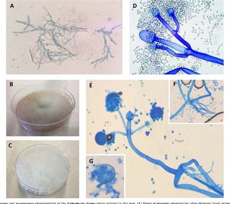 Figure 3 From Update On Actinomucor Elegans A Mucormycete Infrequently