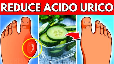 Alimentos efectivos para combatir el ácido úrico YouTube