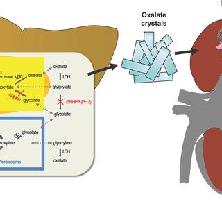 Three Known Gene Defects In Hepatocytes Cause Oxalate Accumulation In