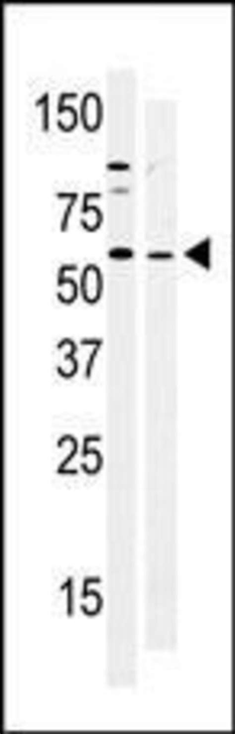 Brk Polyclonal Antibody Invitrogen L Unconjugated Fisher