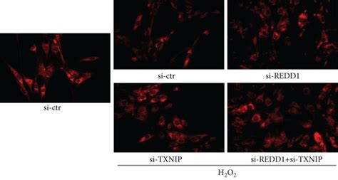 Inhibition Of Redd Txnip Complex Alleviated H O Induced Np Cell