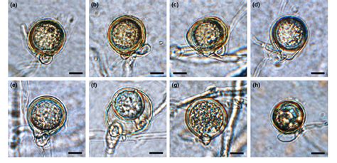 Morphology Of Sexual Structures Of Phytophthora Caryae A A Spherical