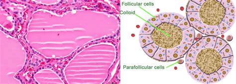 Thyroid Follicles and thyroid parafollicular or C cells. | Download ...