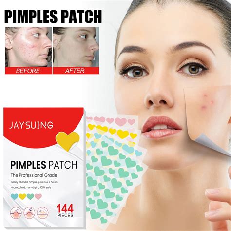 Weloille Love Heart Patches 144 Patches Pimple Patch For Covering Zits And Blemishes