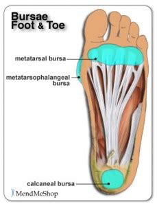 Bursitis Foot Treatment | Treatment For Foot Bursitis in Melbourne