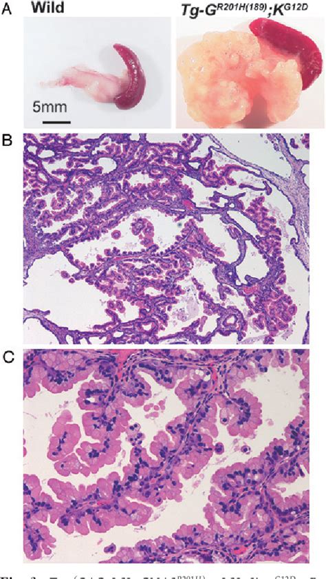 Figure 2 From Development Of A Genetically Engineered Mouse Model Of