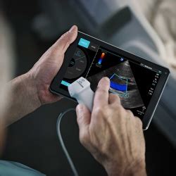 SonoSite announced iViz Portable Ultrasound Device Integration • healthcare-in-europe.com