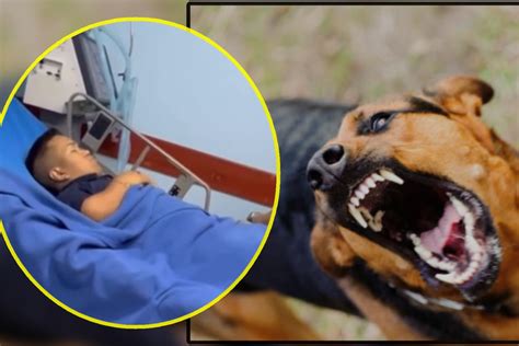 Medio Metro Es Hospitalizado De Emergencia Tras Ser Atacado Por Un Perro Rabioso Y