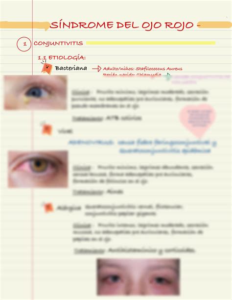 Solution Conjuntivitis Studypool