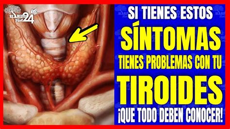 Estos son los SÍNTOMAS DE UN PROBLEMA DE TIROIDES Pero muchas de