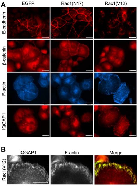 Immunofluorescence Localisation Of E Cadherin Catenin Iqgap And