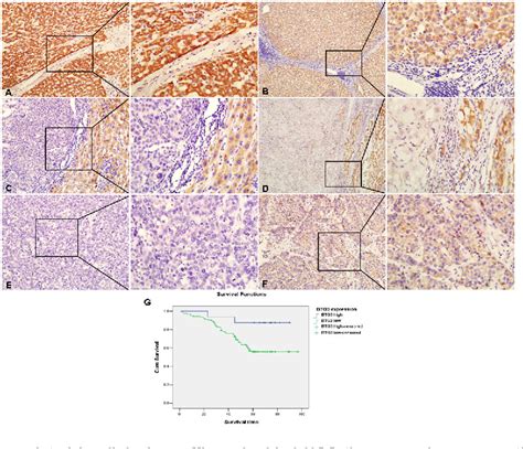 Figure From The Suppressive Role And Aberrent Promoter Methylation Of