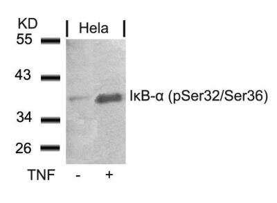 Ikb Alpha P Ser P Ser Antibody Nb Novus Biologicals