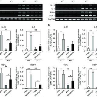 Suppressive Effect Of S P Deficiency On Mrna Expression Of