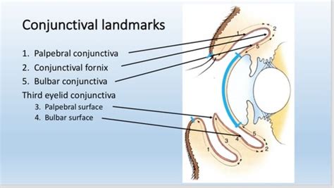 Conjunctiva Flashcards Quizlet