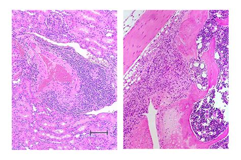 New Spontaneous Mouse Model Sh [image] Eurekalert Science News Releases