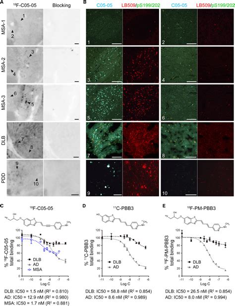 Imaging α Synuclein Pathologies In Animal Models And Patients With