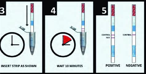 Laboratory Procedure To Set Up And Read The Cryptococcal Antigen Download Scientific Diagram