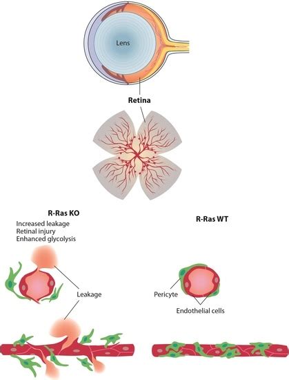 Ijms Special Issue Novel Insights In Retinal Diseases