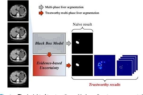 Figure 1 From Trustworthy Multi Phase Liver Tumor Segmentation Via