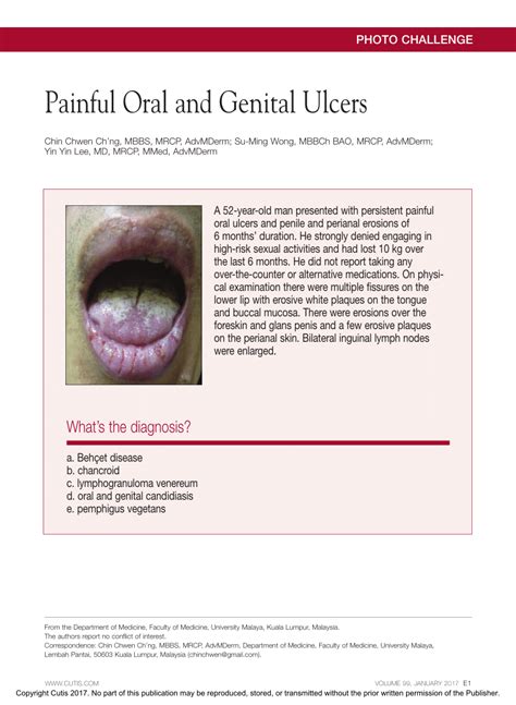 Pdf Painful Oral And Genital Ulcers