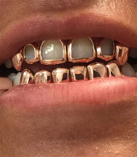 10K SOLID GOLD 6 TOP 6 BOTTOM Gold Teeth Master