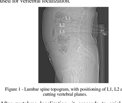 Figure From Quantitative Computed Tomography Versus Densitometry In