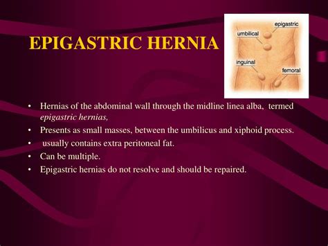 Epigastric Hernia Types