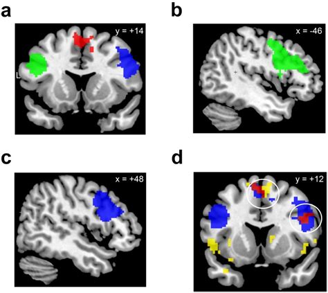 The Three Rois Were Functionally Defined By The Brain Activation During Download Scientific