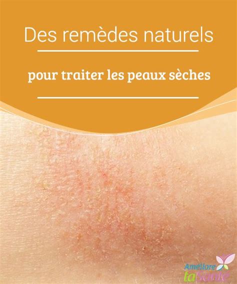 Des Remèdes Naturels Pour Traiter Les Peaux Sèches Remèdes Naturels