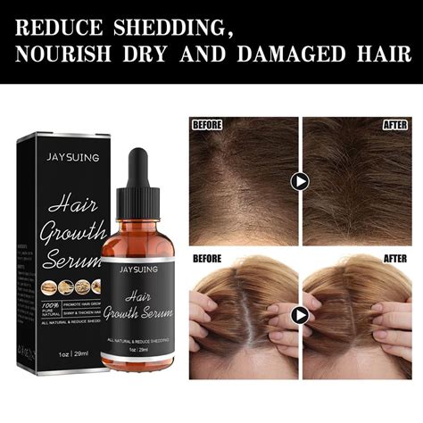 Hair Growth Serum For Black Women With Chebe Allurium Beauty Hair