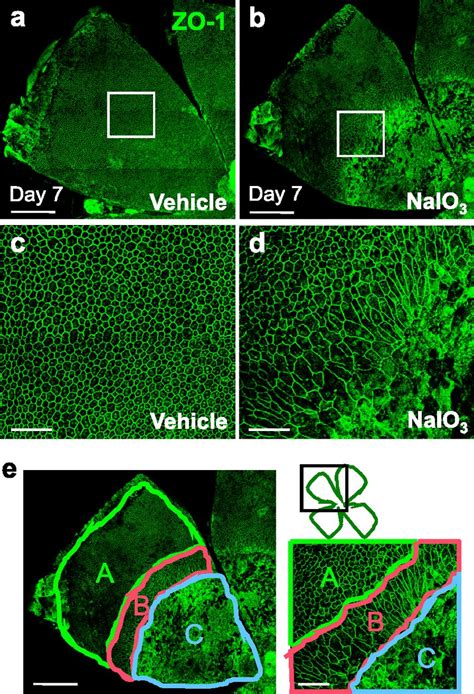 Sirt Overexpression In The Nucleus Protects Mouse Retinal Pigment