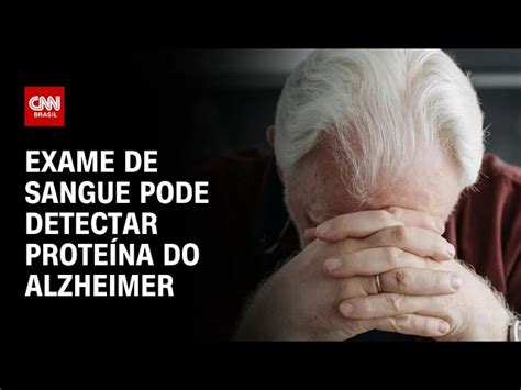 Exame De Sangue Que Rastreia Alzheimer Pode Se Tornar Realidade Diz