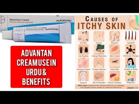 Advantan Cream Use In Urdu Benefits And Side Effects Youtube