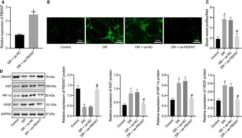 Overexpression Of Fbxw Inhibits Intraretinal Angiogenesis In Dr Mice