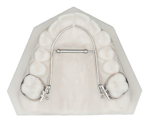 Transforce Palatal Expander Protec Dental