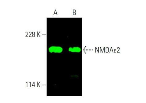 Nmda A Scbt Santa Cruz Biotechnology