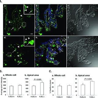 Photomicrographs illustrating gut sections from FcRn+/+ (a, b, c) and... | Download Scientific ...