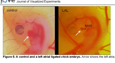 Figure 5 From An Ex Ovo Chicken Embryo Culture System Suitable For