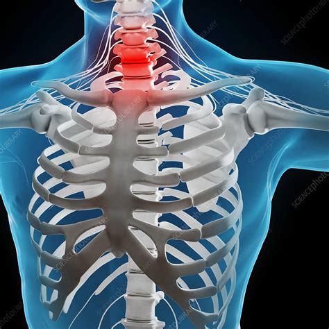 Human Ribcage Artwork Artwork Stock Image F Science