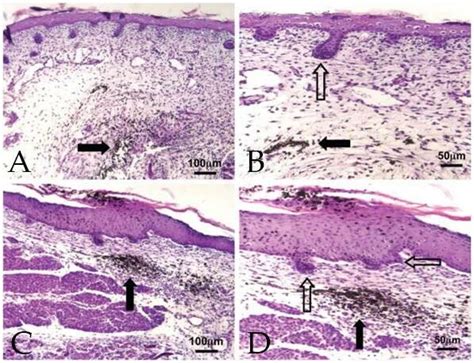 Scarless Fetal Wound Healing Occurs Across Species The Picture Is